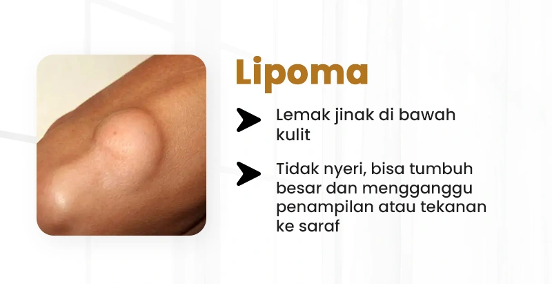 6.webp
