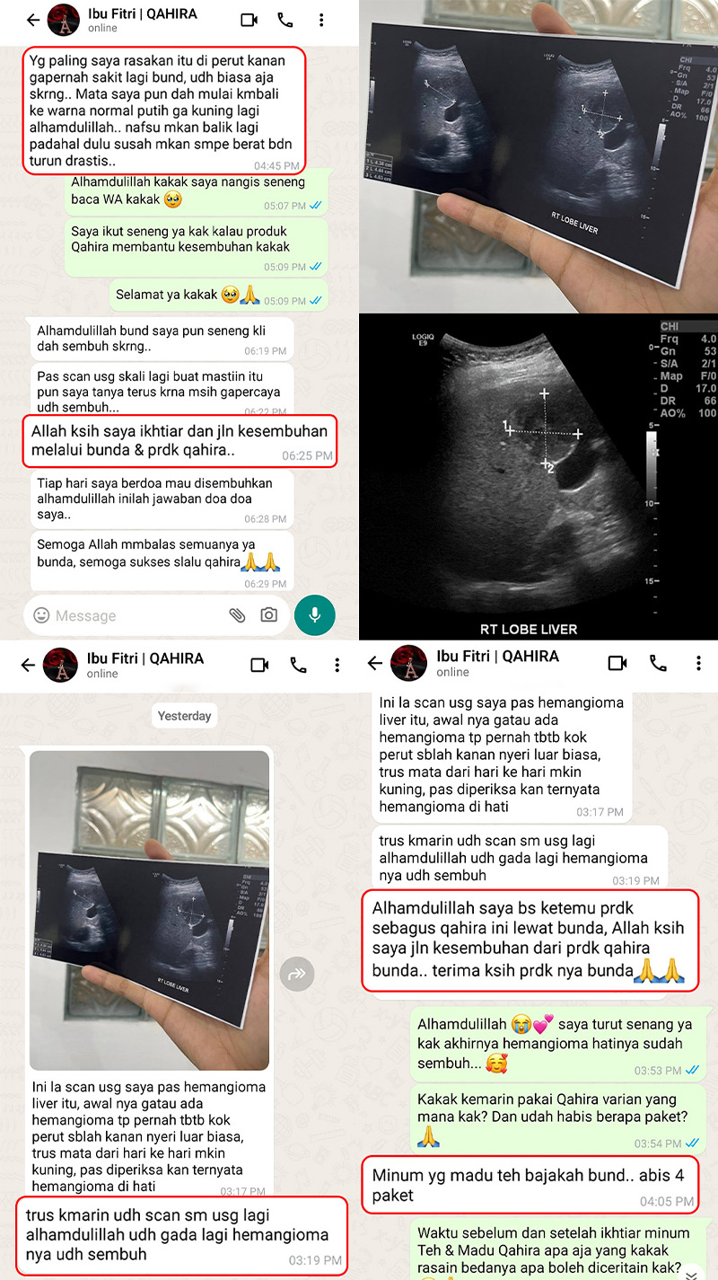 testi-wa-1.webp