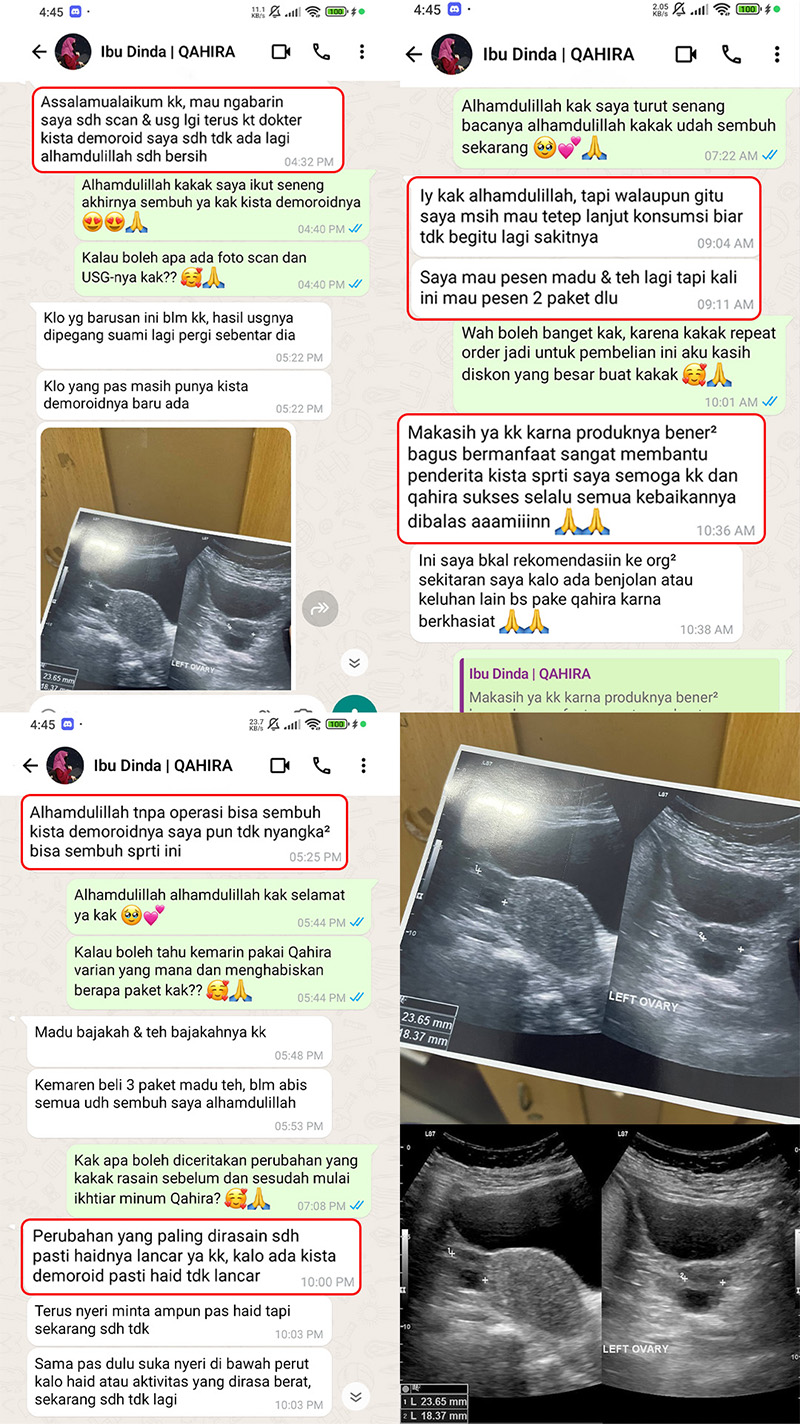 testi-wa-2.webp